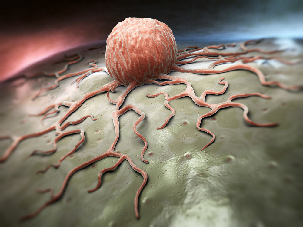 cellules cancéreuses