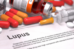 Le diagnostic de lupus