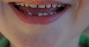 choc dentaire chez l’enfant