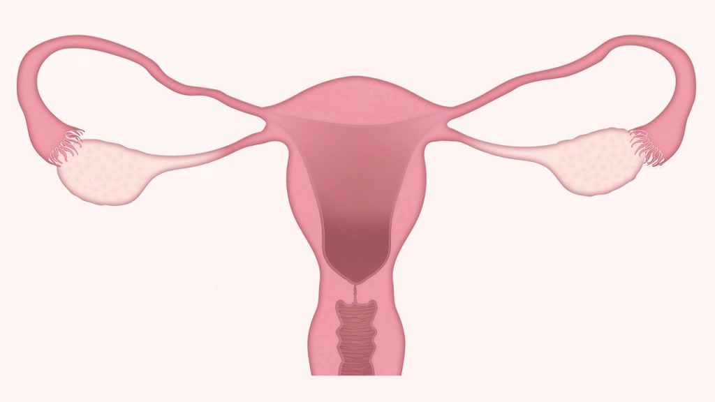 cancer du col de l'utérus