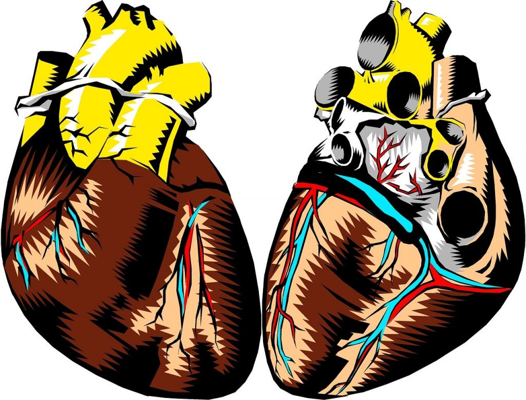 implantation de valve aortique