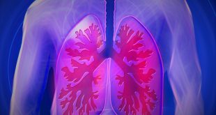 cancer des poumons