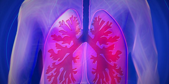 cancer des poumons