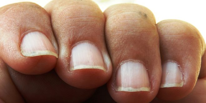 fortifier les ongles fragiles