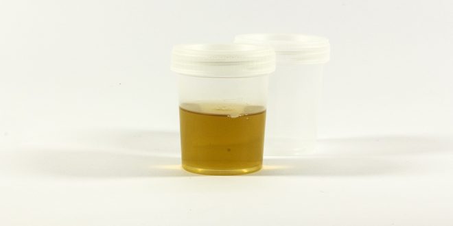 urine malodorante