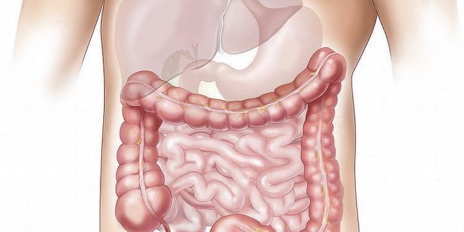 polype intestinal