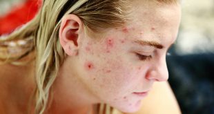 reconnaître la dermatite négligée